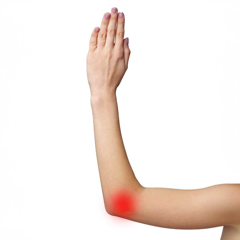 elbow lateral epicondylalgia
